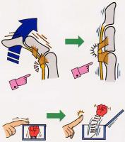 ばね指の症状が出やすい場所